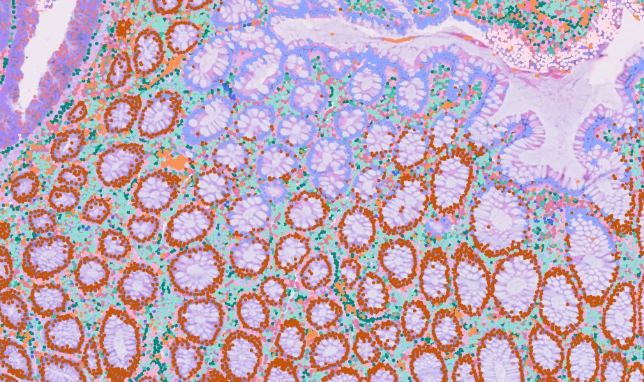 10X Genomics Xenium - Human colon