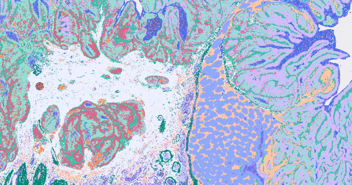 10X Genomics Visium HD - Human colon