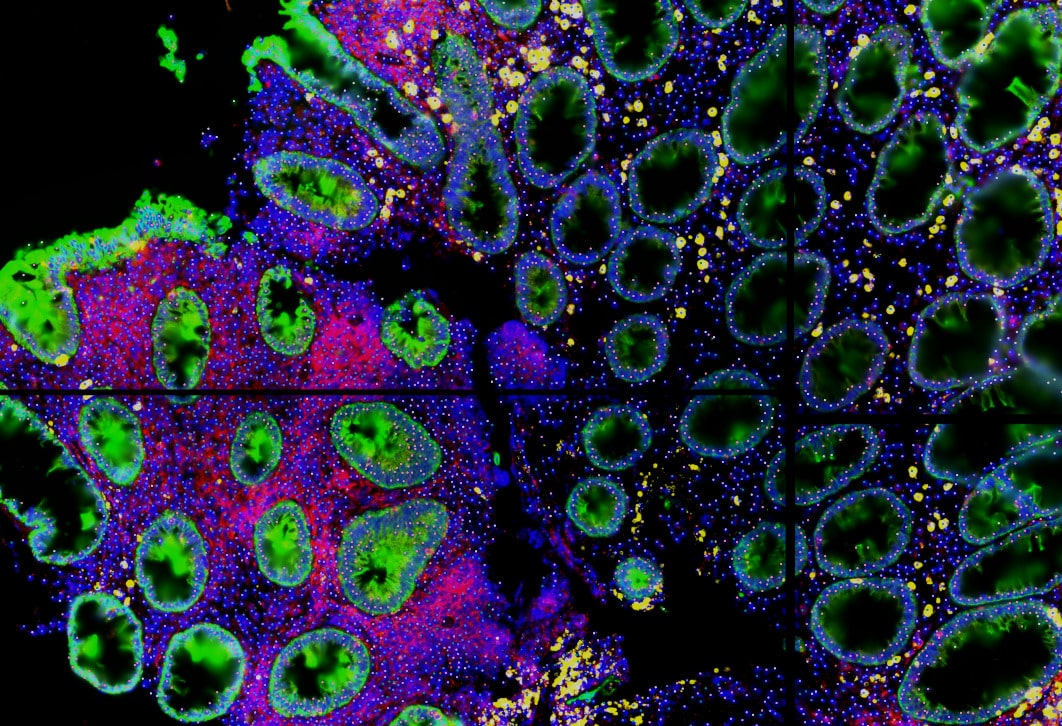 Nanostring CosMx - Human colon