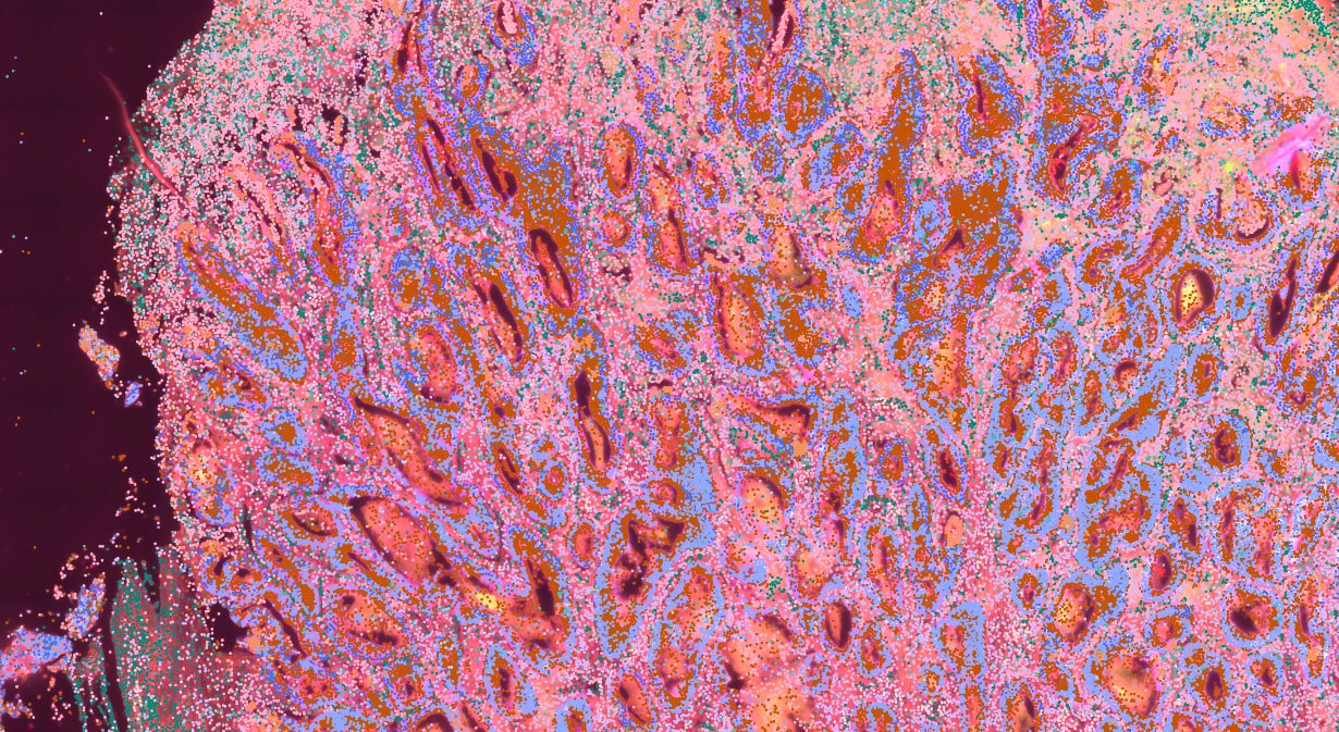 Vizgen MERSCOPE - Human colon